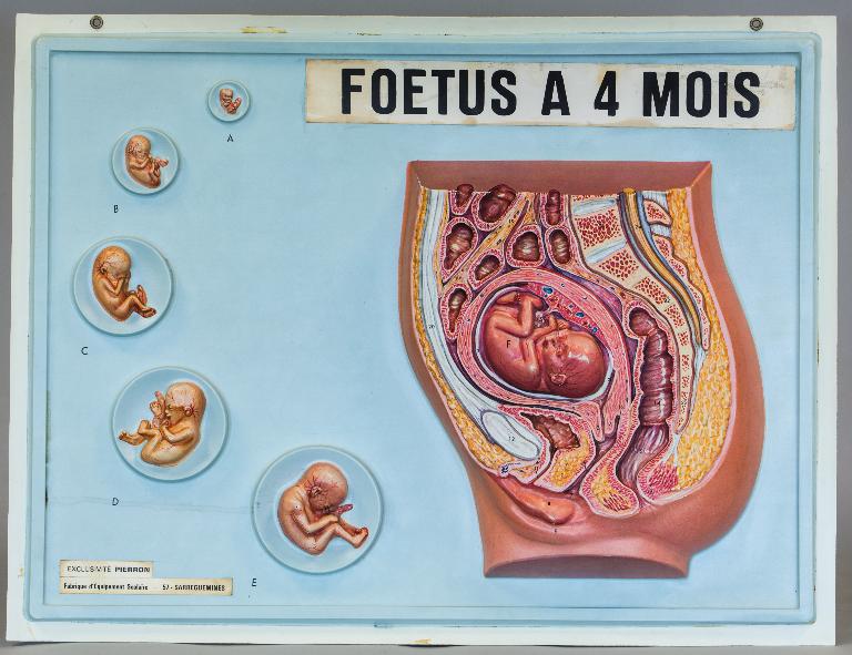 Objets de présentation d'un organisme vivant : objets des établissements Pierron à Sarreguemines